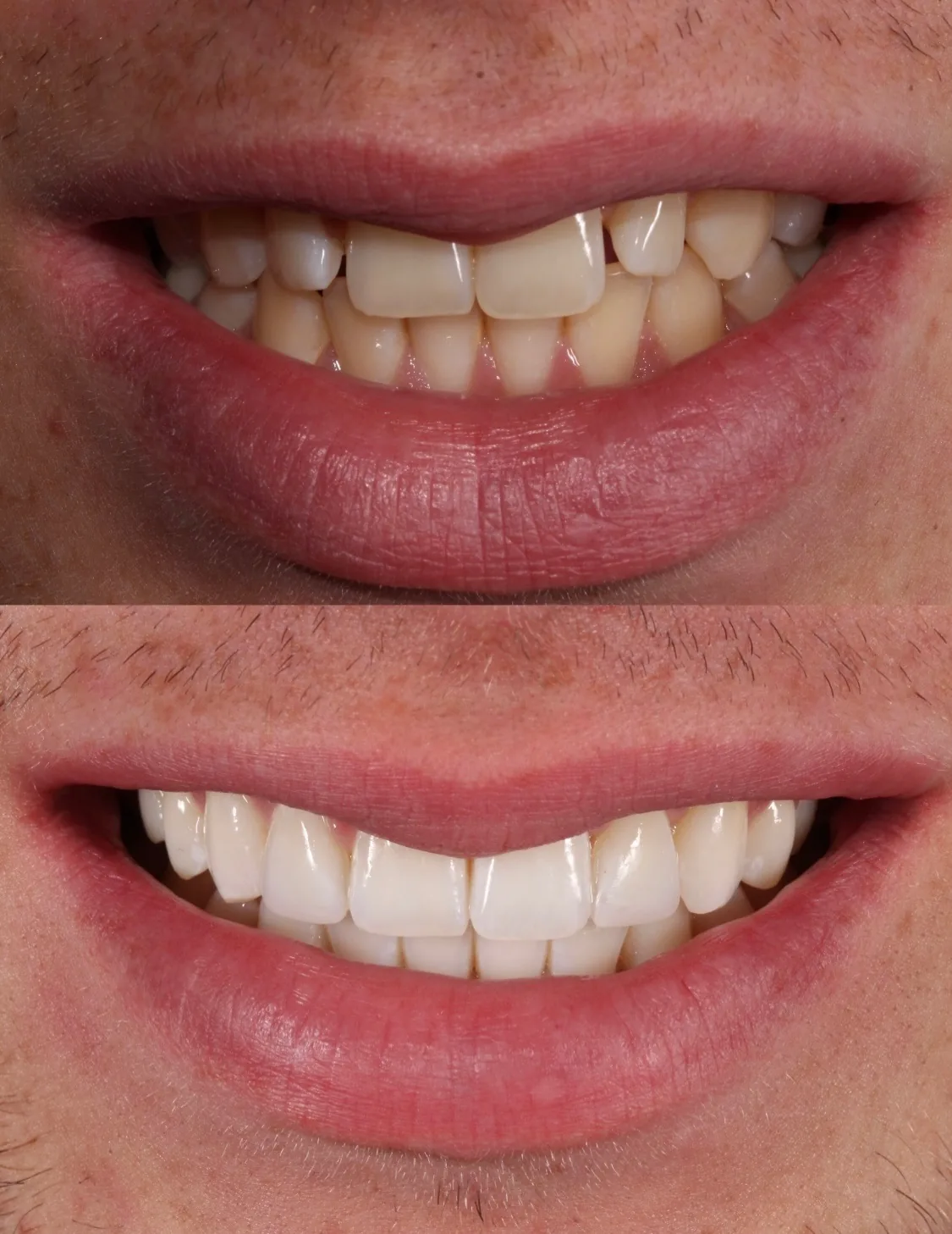 VICI Dental photo 4
