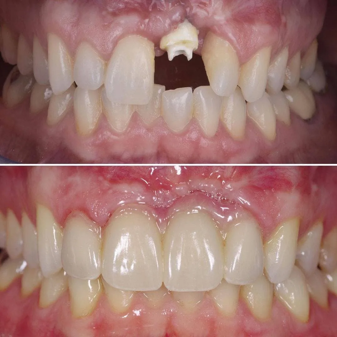 Bangalore Dental & General Polyclinic photo 4