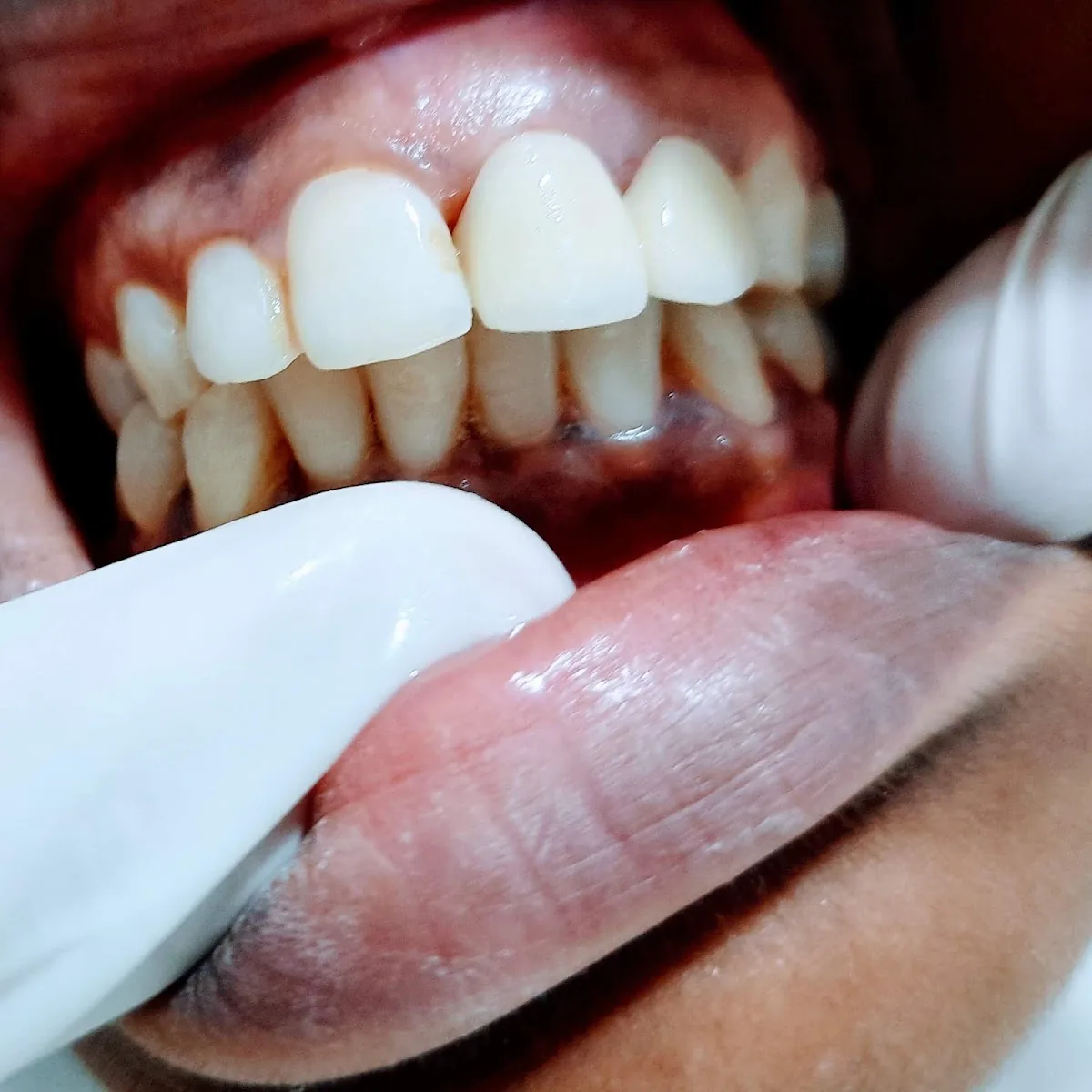 Zenith Dental Care and Implant Centre photo 2