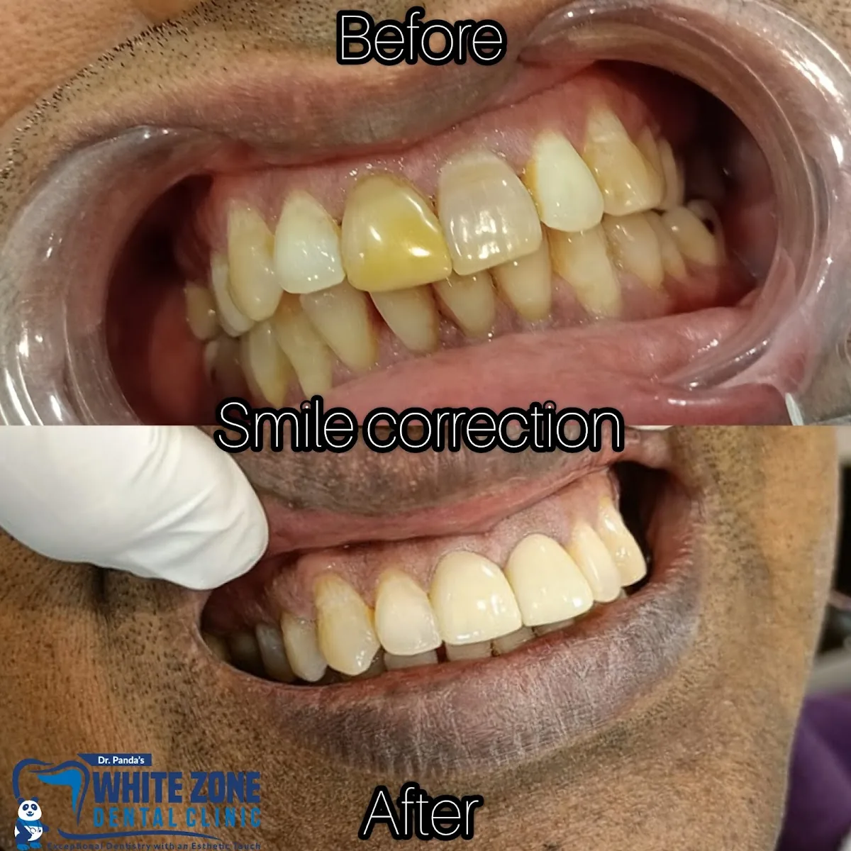Whitezone Dental Clinic photo 3