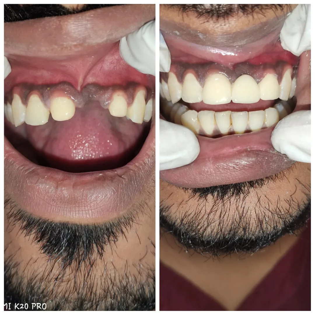 Dr Indra Dental Clinic photo 6