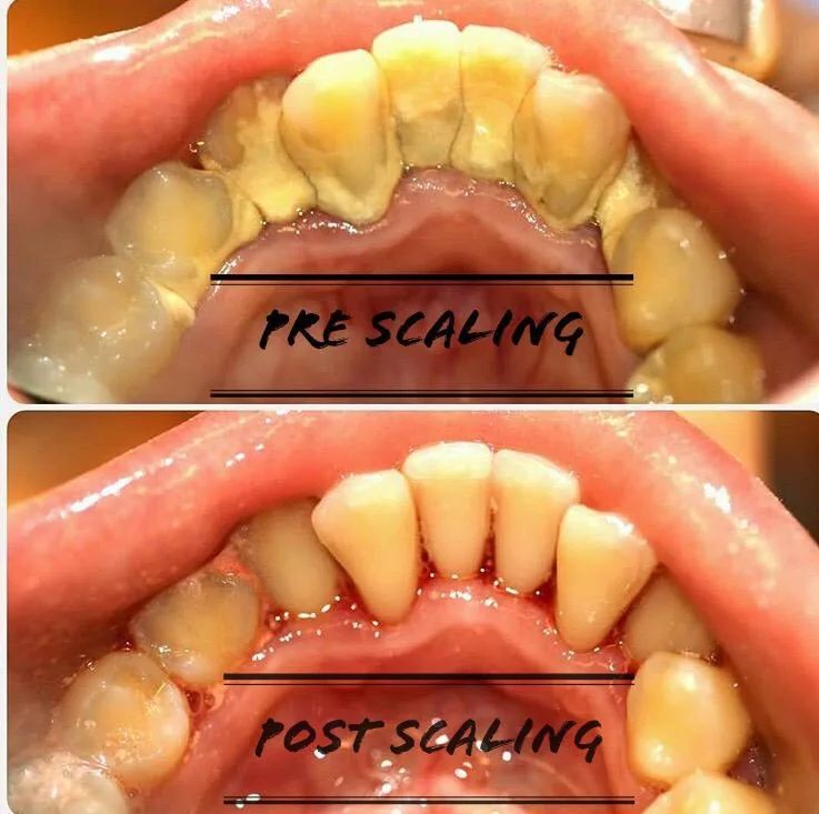 32 PEARLS DENTAL CLINIC photo 5