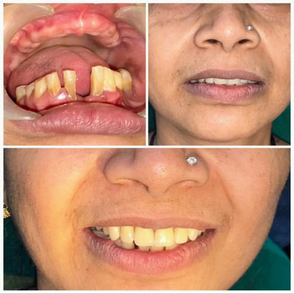 32 PEARLS DENTAL CLINIC photo 6