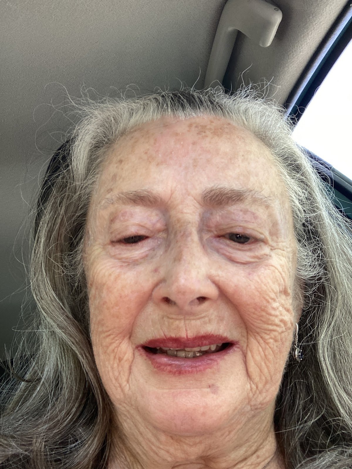 Fiori Dental San Mateo photo 4