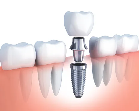 Whitlow Dental Care photo 4
