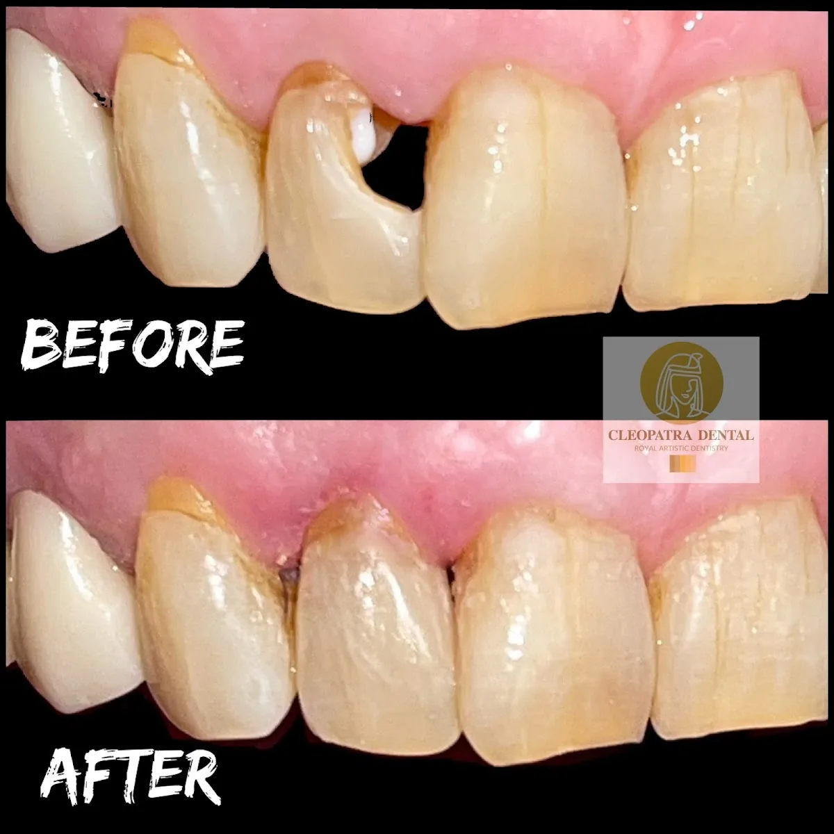 Cleopatra Dental | Huntington Beach Dentist photo 4