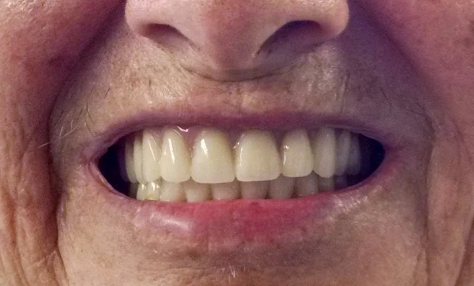 Peter Mani, DDS photo 6