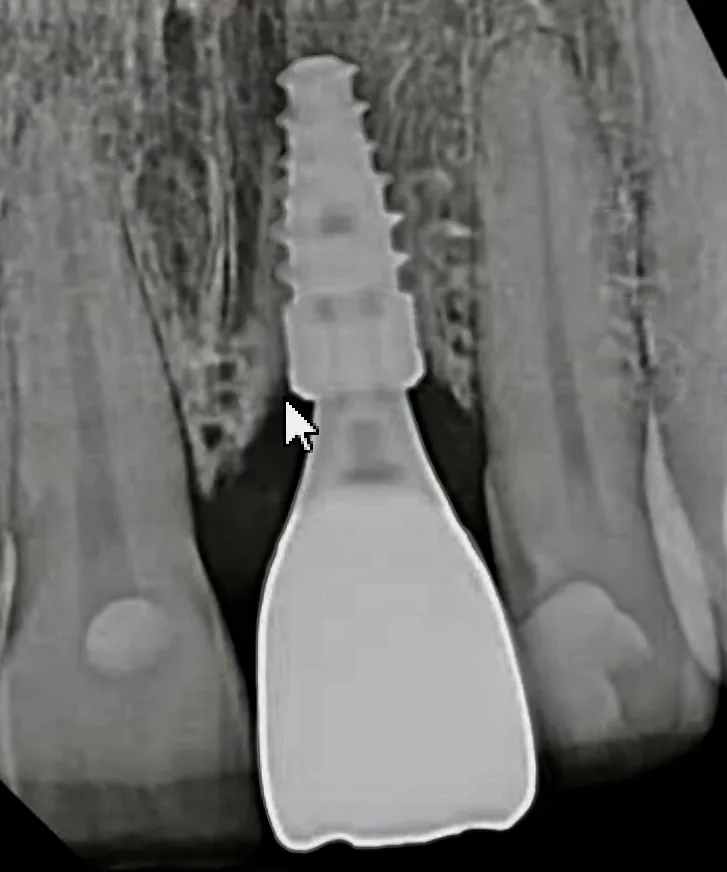 Laurel Smile Dentistry photo 4