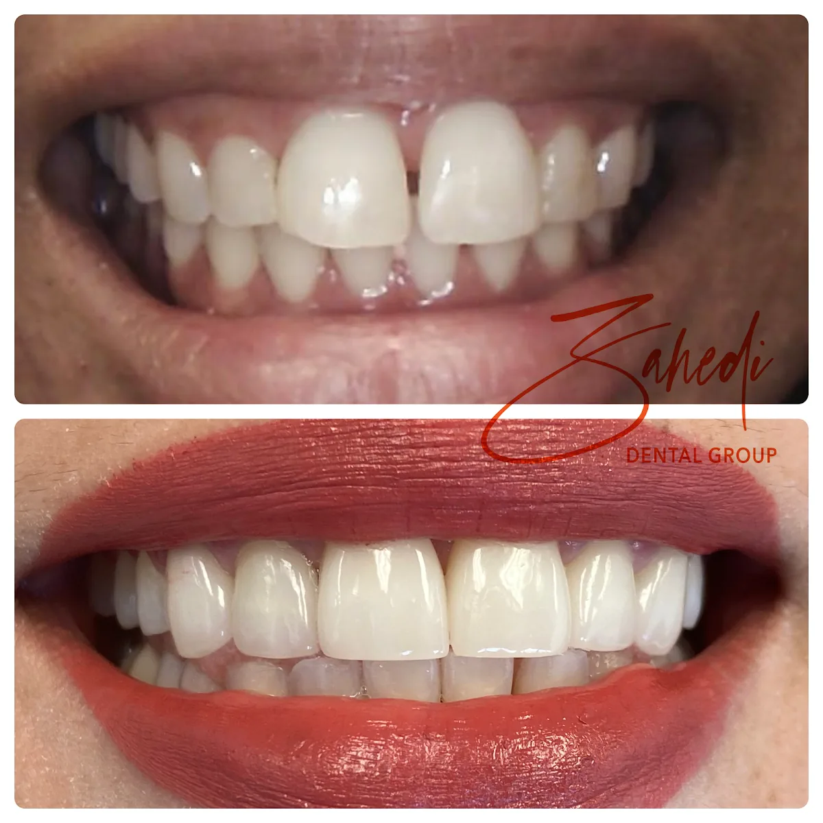 Kathy Zahedi, DDS & Associates - Santa Monica Dentists photo 3