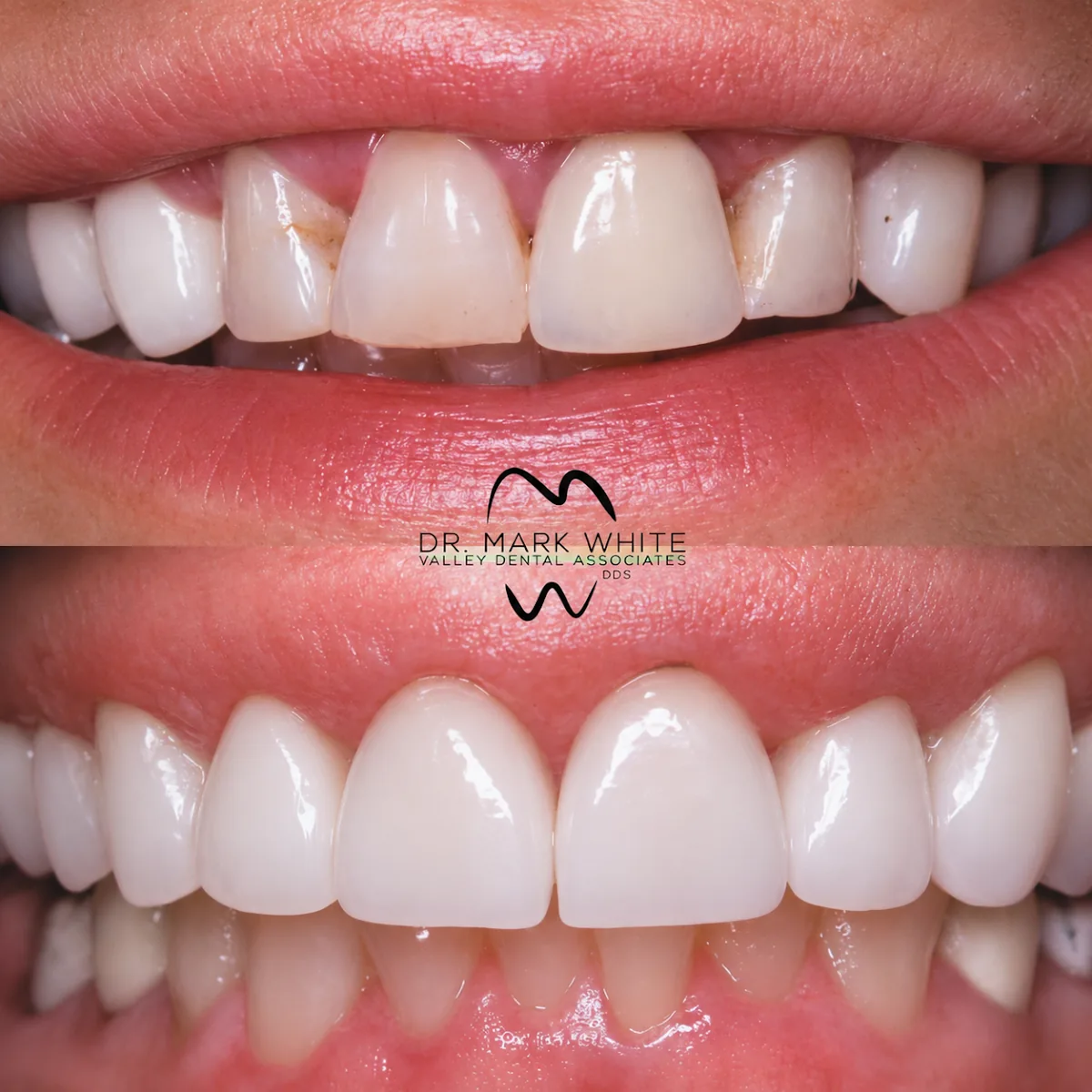 Dr. Mark White-Valley Dental Associates