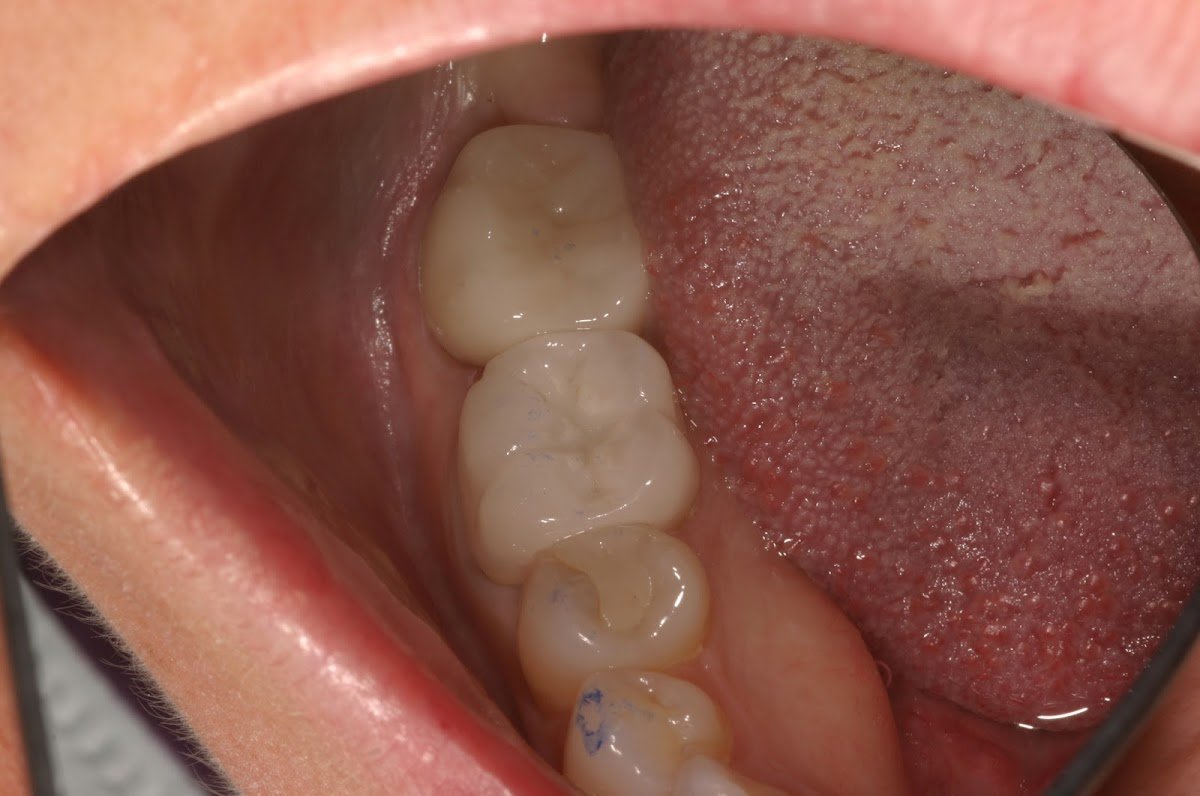 Salem Dentistry: Roxana Salem, DDS photo 3