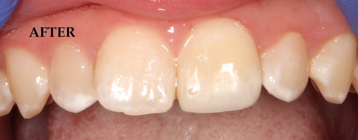 Japantown Dental: Alex H. Mendoza, DDS photo 5