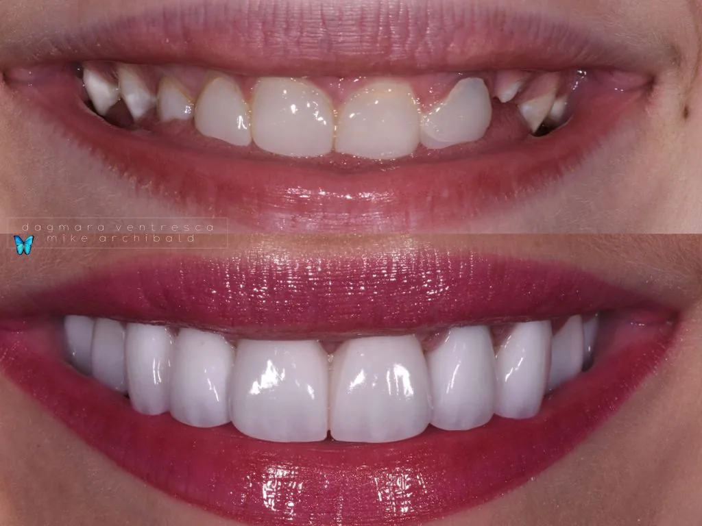West Lafayette Dental Studio photo 4