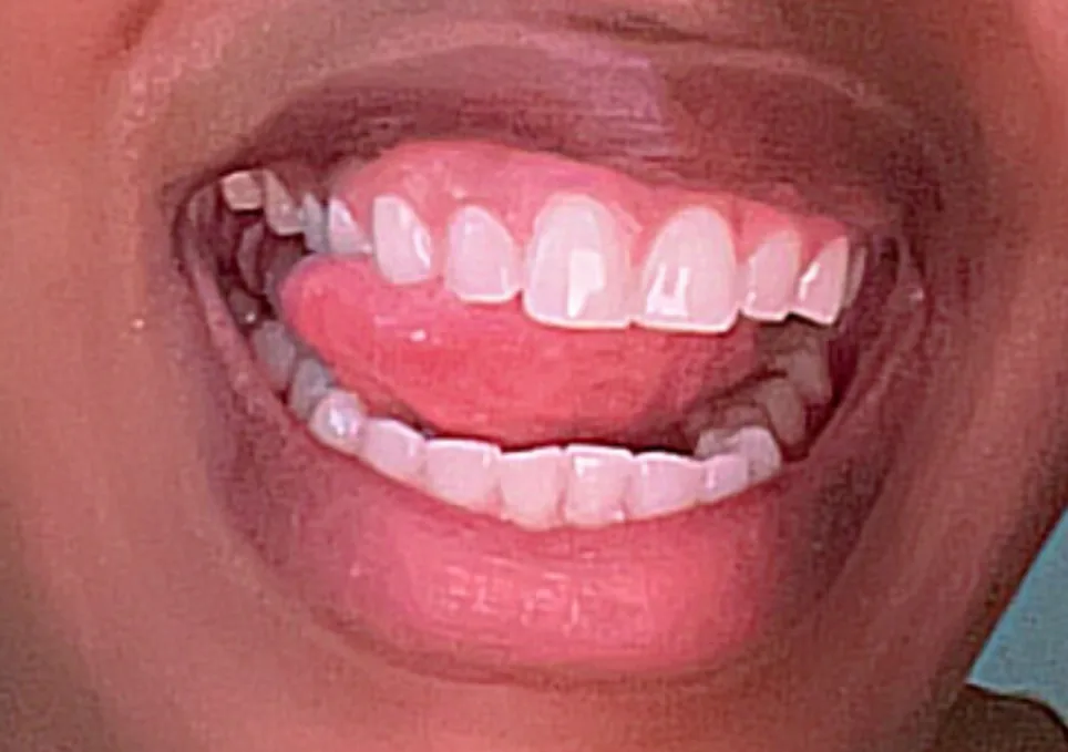 Nova Family Dentistry of Tyrone photo 3