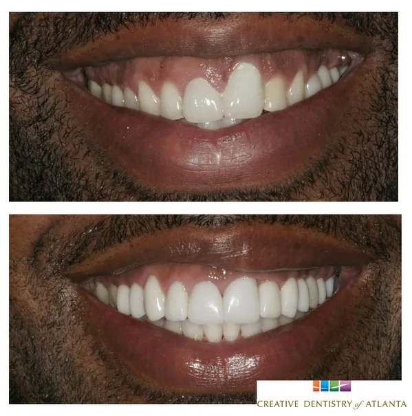 Creative Dentistry & Medspa photo 3