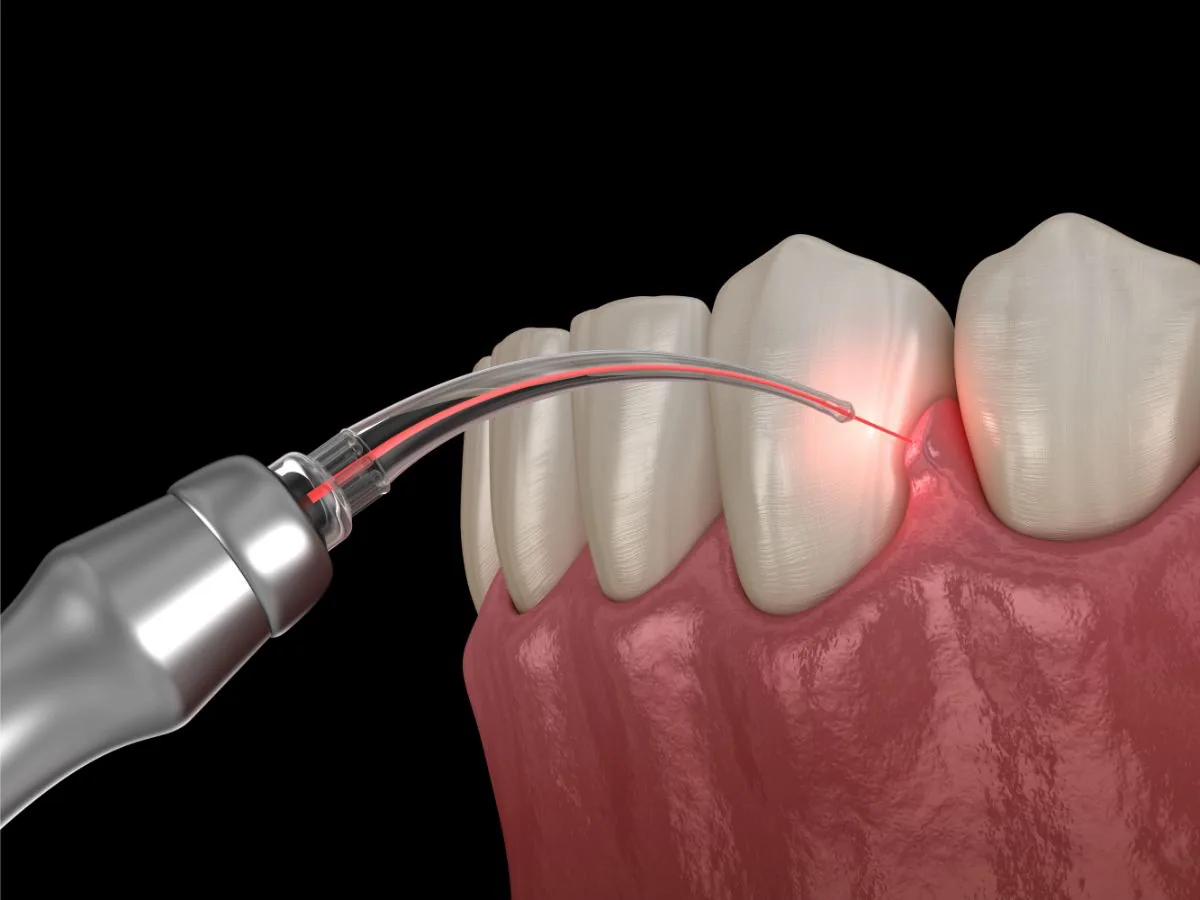 Appletree Family Dental photo 5