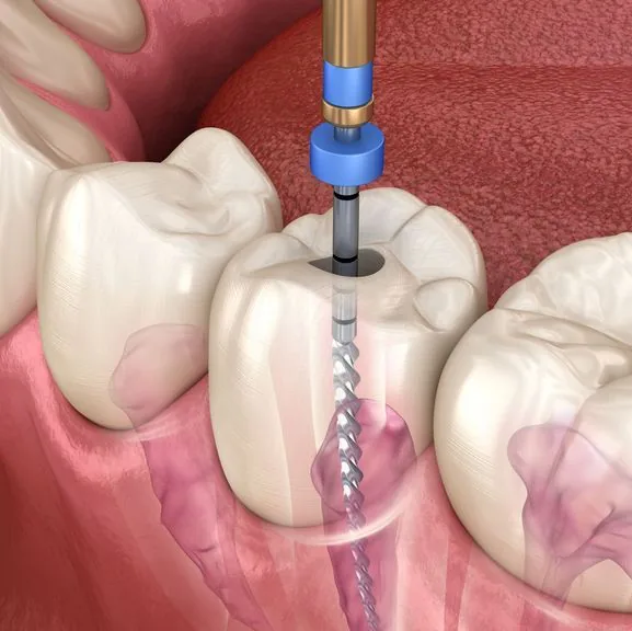 Appletree Family Dental photo 6