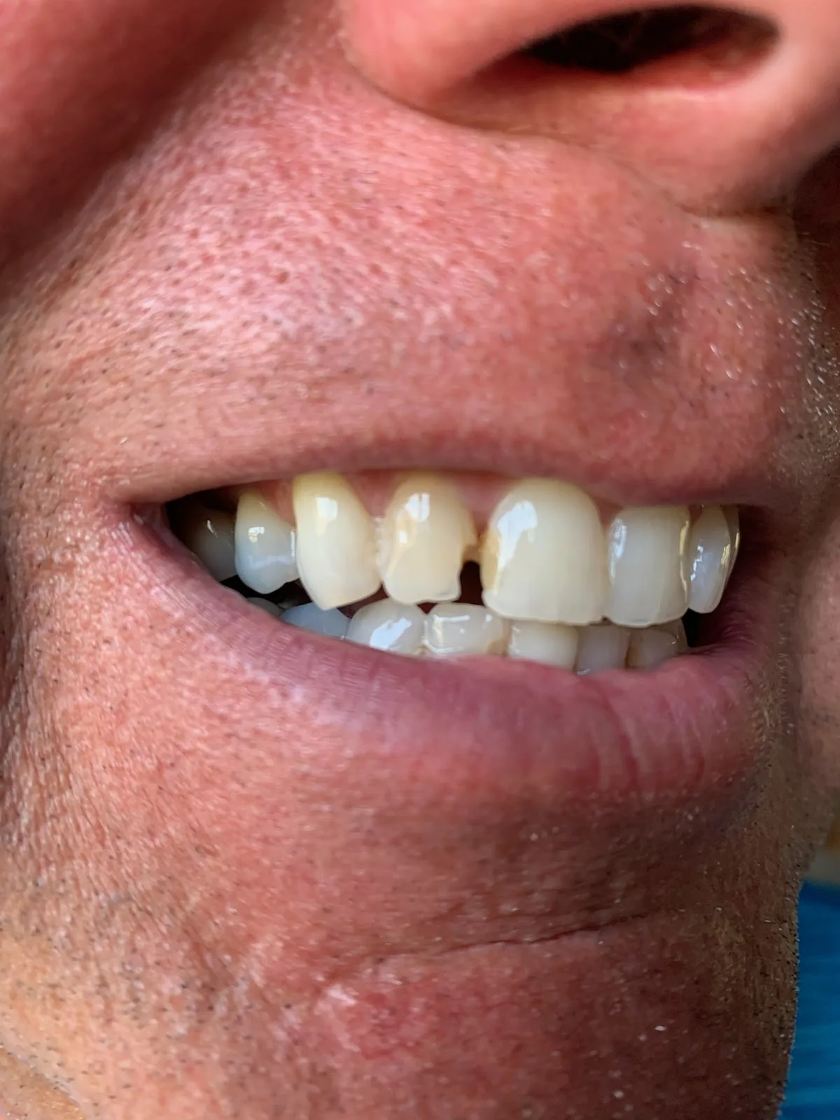 Olathe Family Dentistry