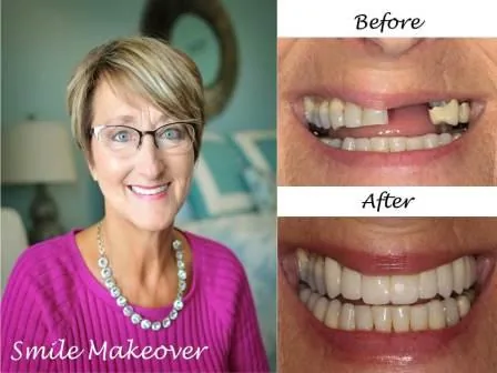 Arbor Creek Dental photo 6