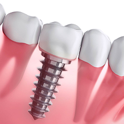 Brij Dental Clinic (Multispeciality Dental Clinic, Laser & Implant Center) photo 1