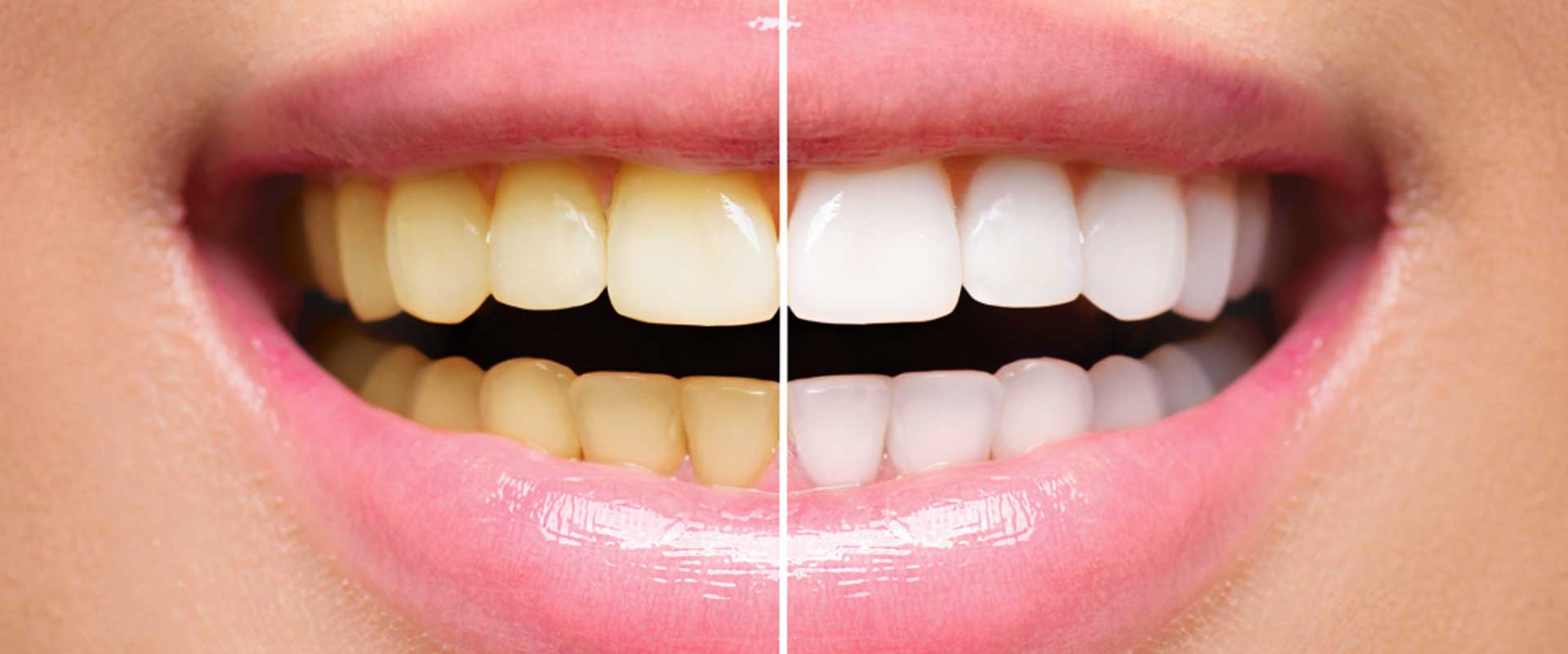 Canberra Dental Care – Dr Zoe Muir photo 1