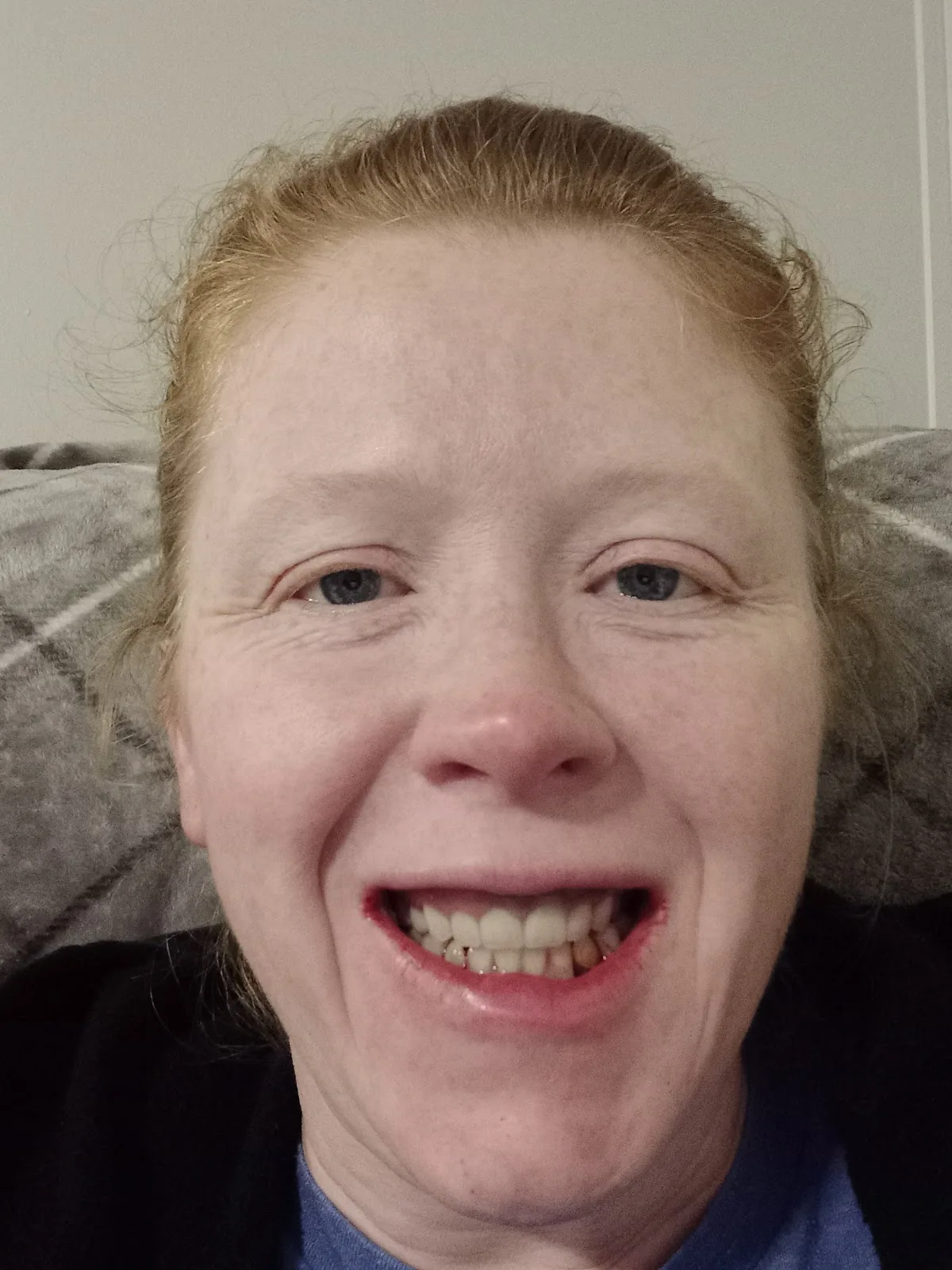 Affordable Dentures & Implants photo 5