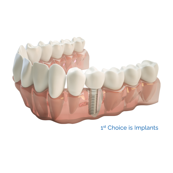 Facets – Cosmetic Dental Clinic photo 1