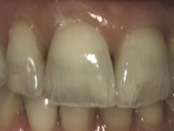 Thomas E Ouellette, DDS PC photo 1