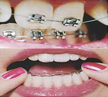 MT A Dental Centre Mount Alvernia (Progressive Dental Specialists Pte Ltd) photo 1