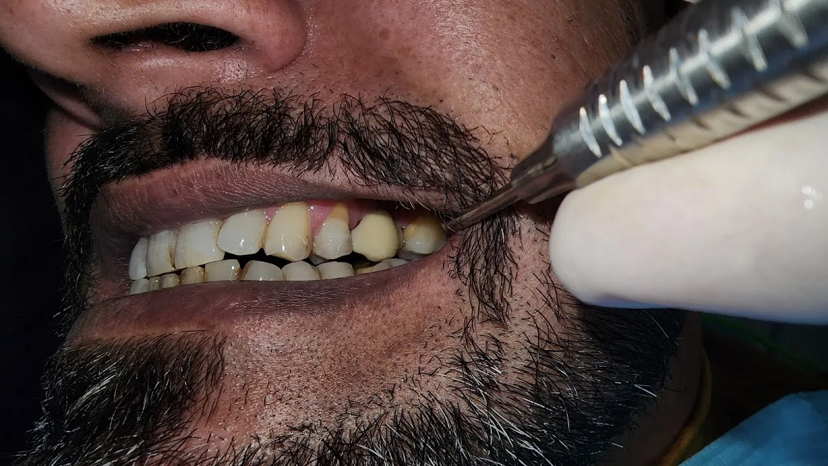 Ilham Dental Clinic Dubai Marina Diamond 3 photo 2