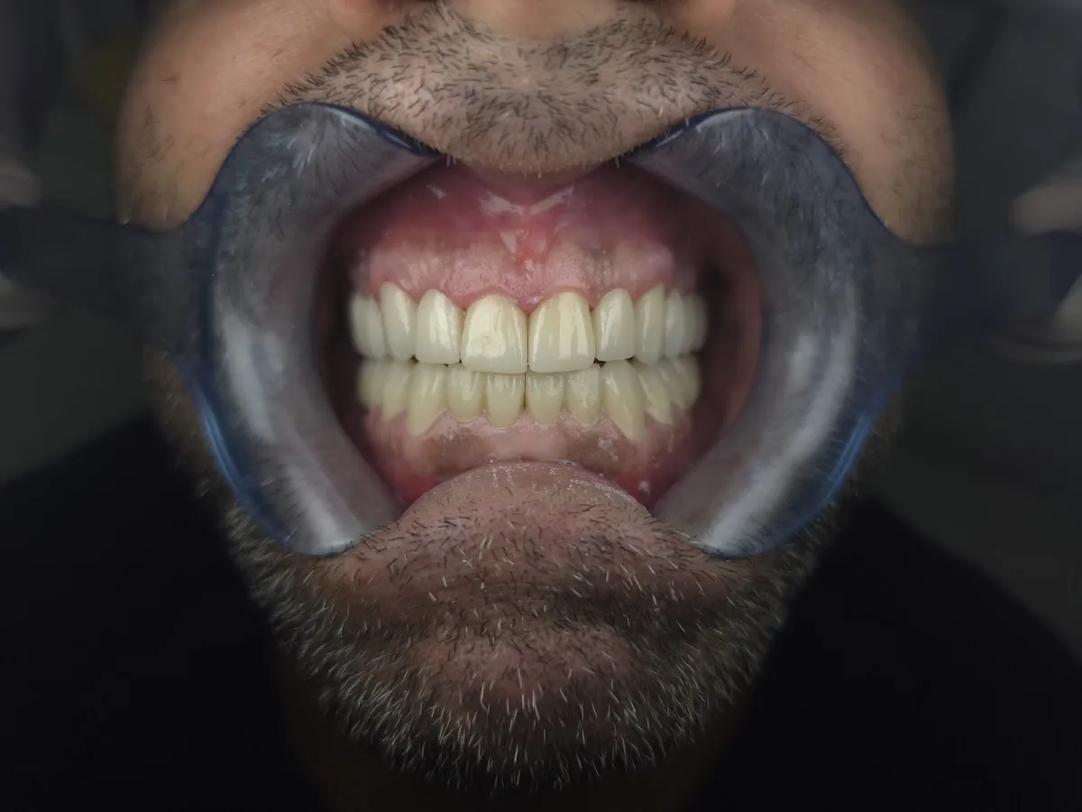 Ilham Dental Clinic Dubai Marina Diamond 3 photo 5