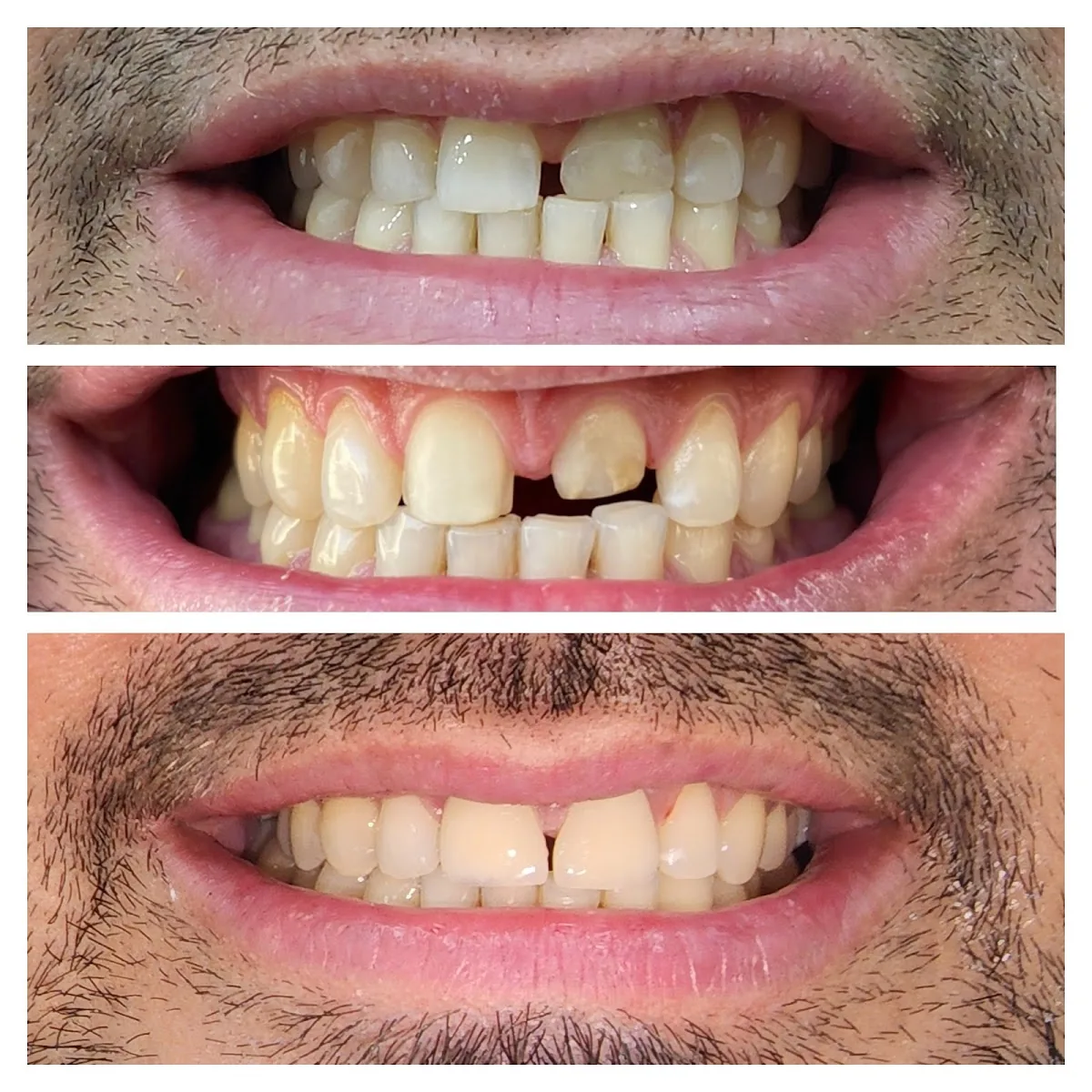 Ilham Dental Clinic Dubai Marina Diamond 3 photo 1