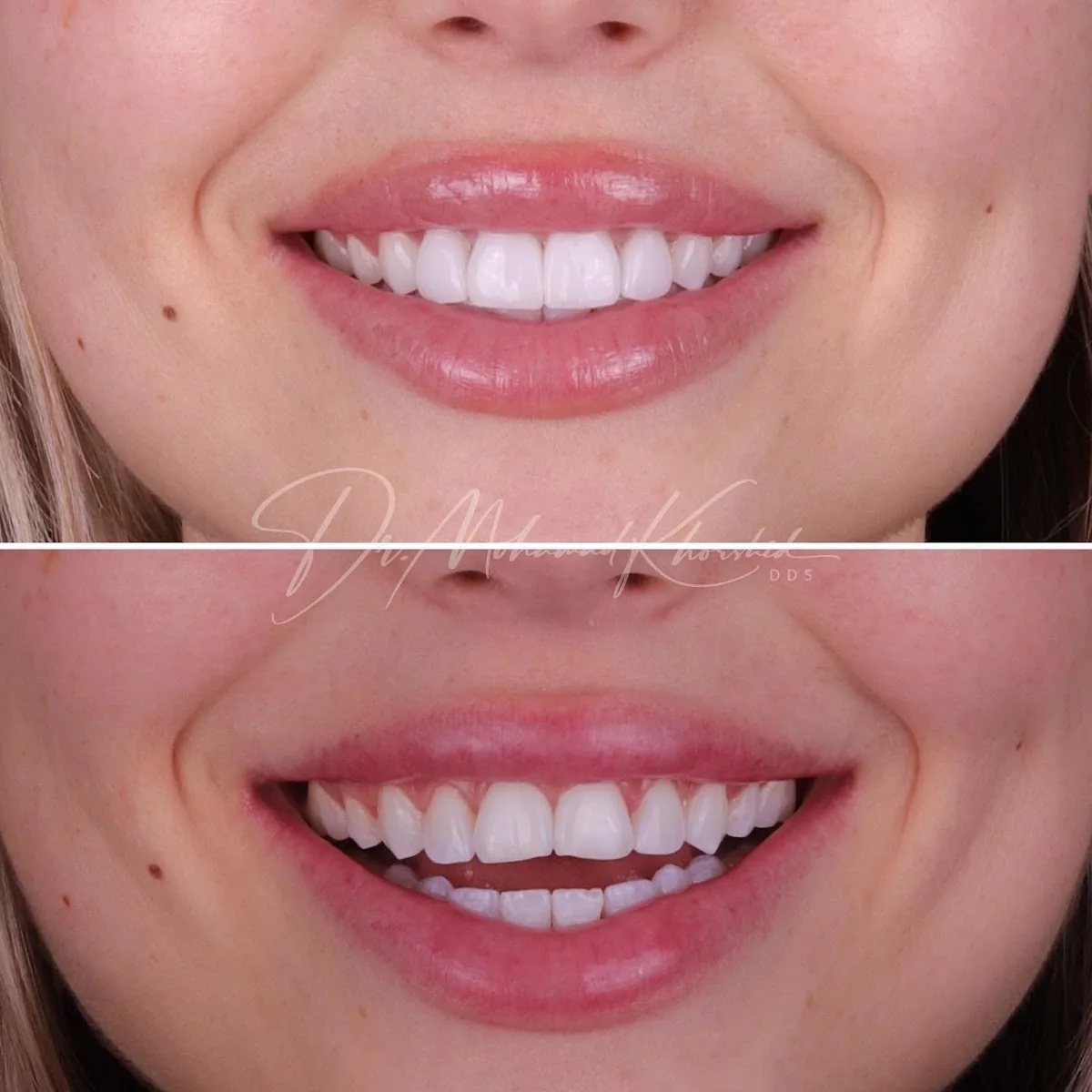 Mississauga Smiles Dentistry photo 2