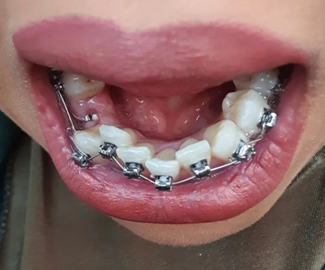 Avance Dental Clinic - IBN Battuta photo 3