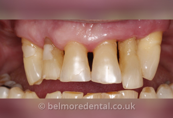 Belmore Dental Implant & Facial Clinic photo 1