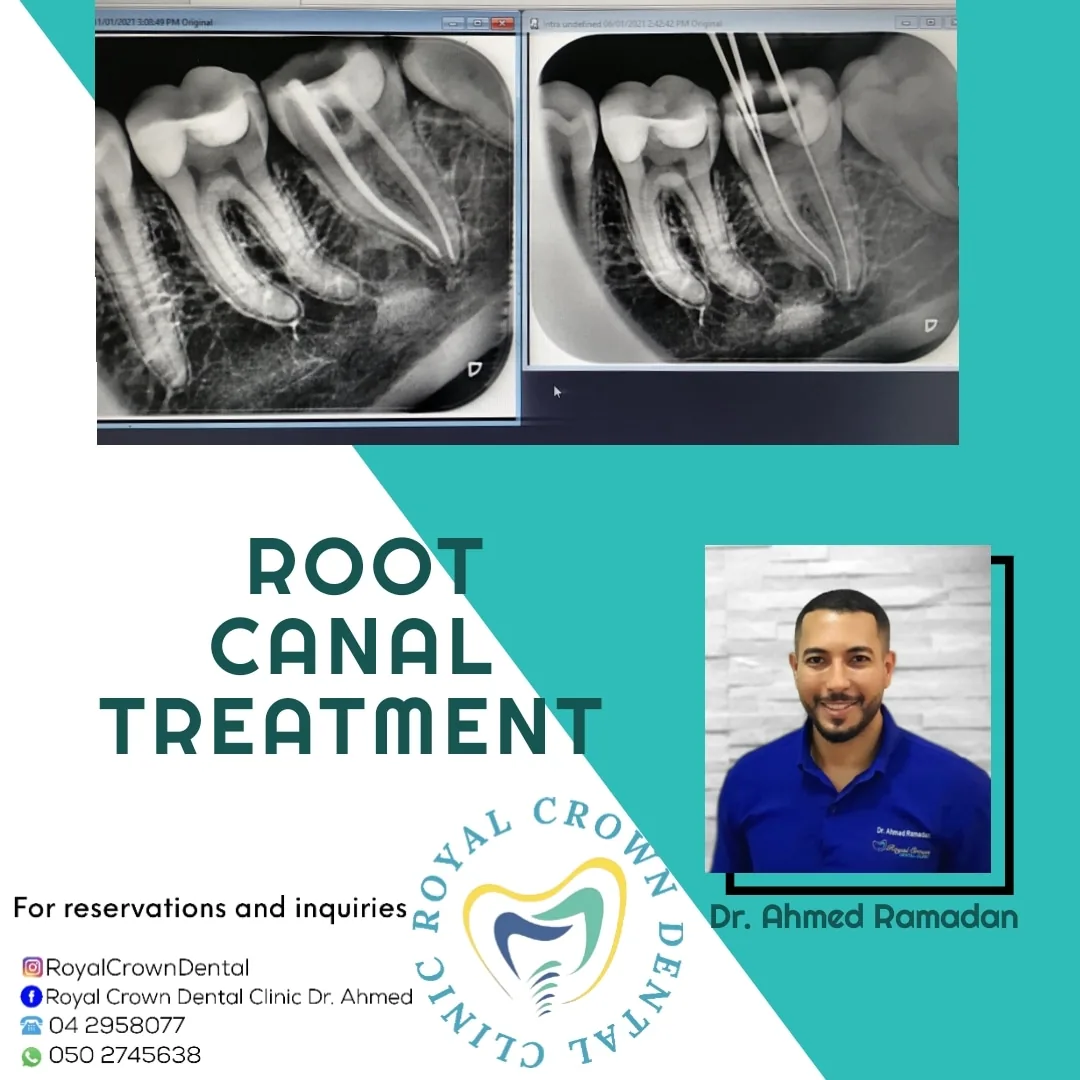 Royal Crown Dental Clinic photo 3