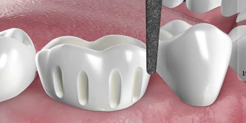 Howick Dental Surgery photo 1