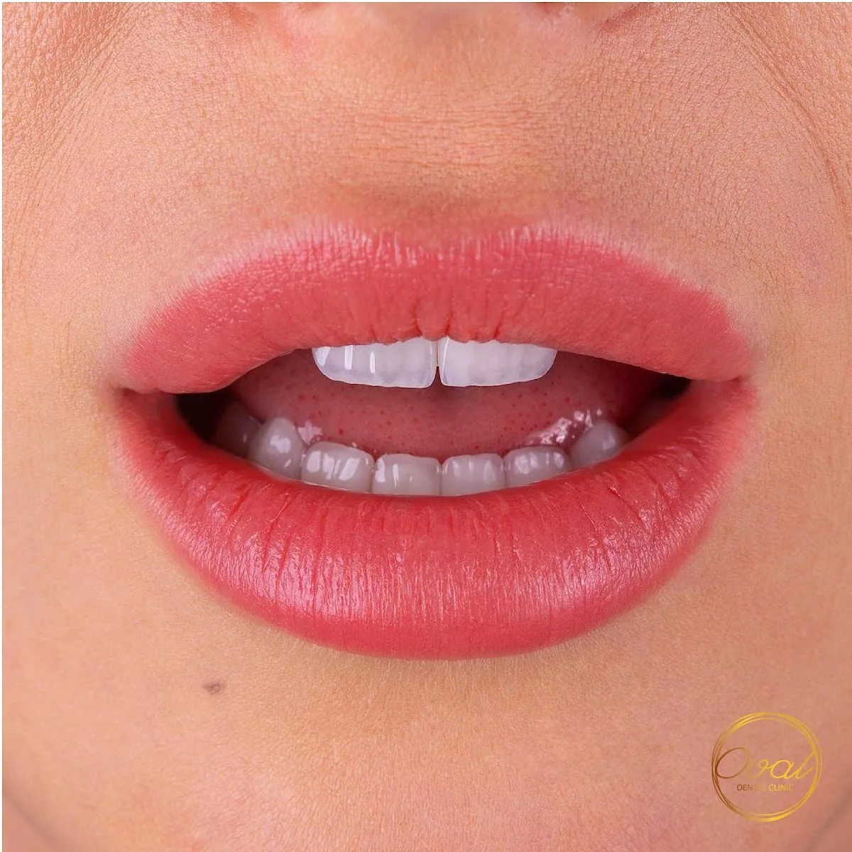 Oval Dental Clinic photo 5