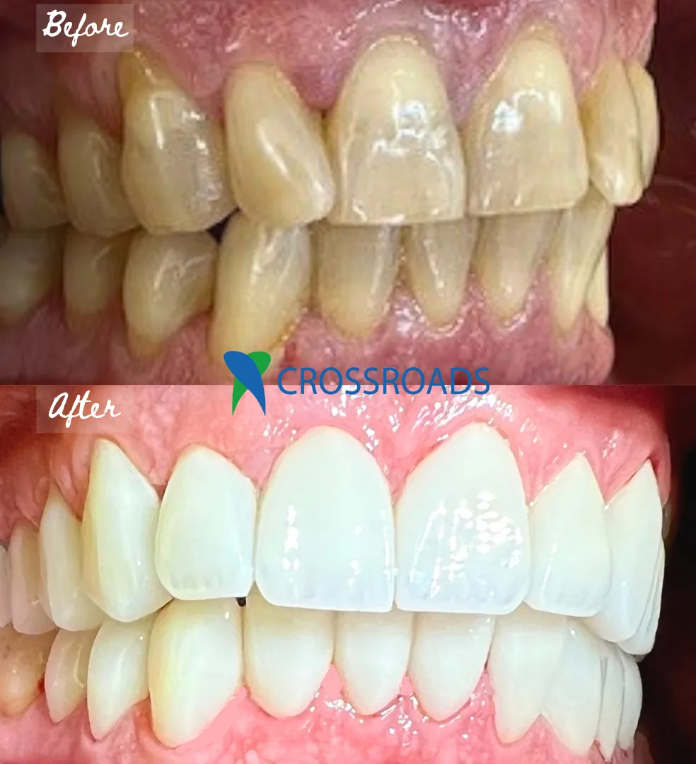 Crossroads Dental Clinic - Sheikh Zayed Road, Dubai photo 3