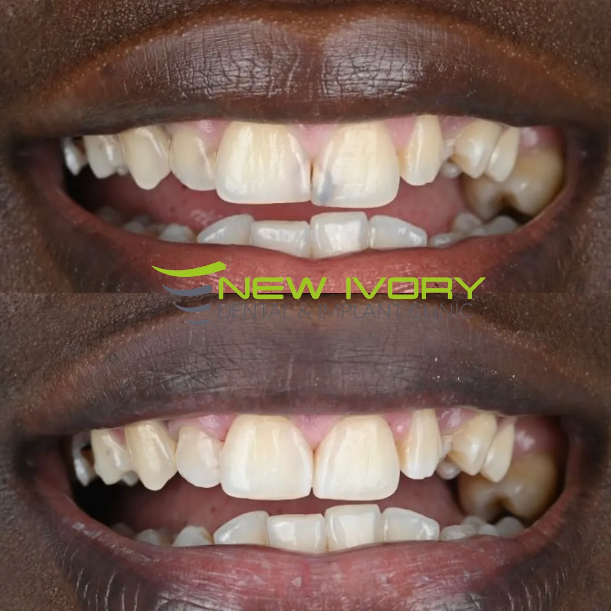 New Ivory Dental and Implant Clinic photo 4