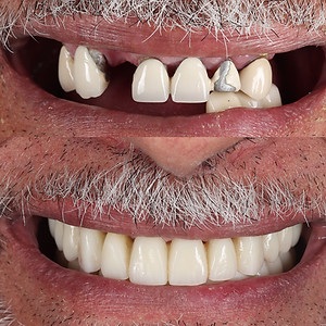 Monument Dental Studio photo 1