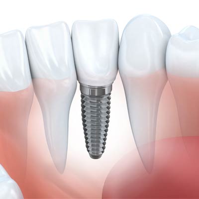 Oaklands Dental Surgery photo 1