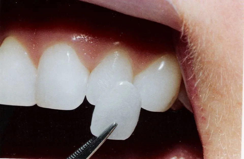 Dubai Smile Dental Clinic photo 6