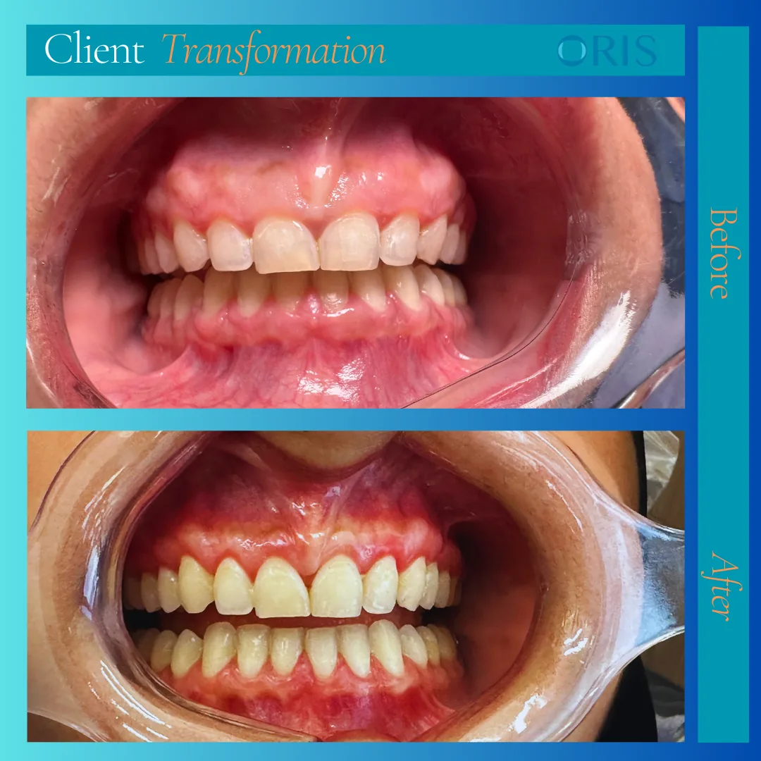 Oris Dental Centre - Jumeirah, Dental Implants, Dental Veneers & Hollywood Smile Specialist photo 4