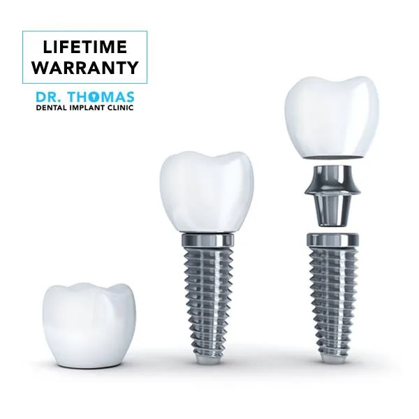 Dr. Thomas Dental Implant Clinic DMCC photo 4