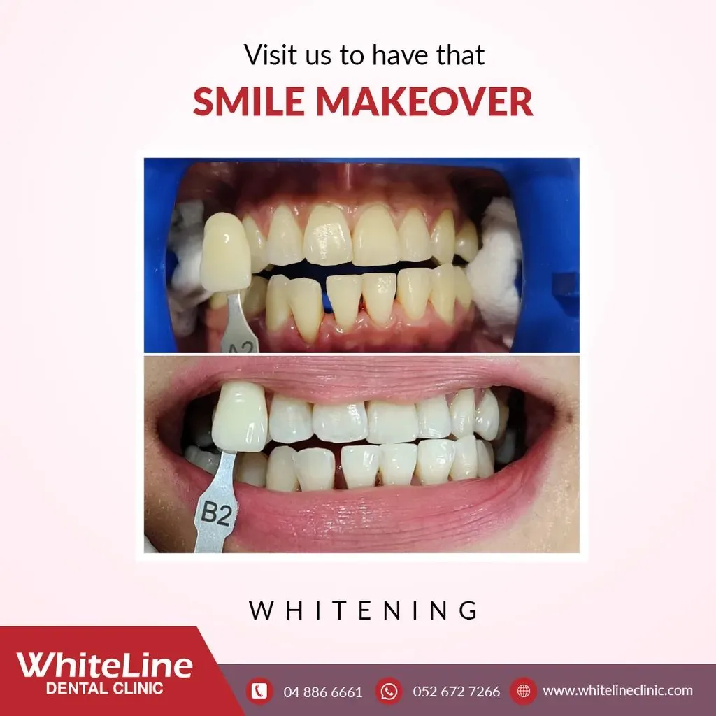 White Line Dental Clinic LLC photo 5