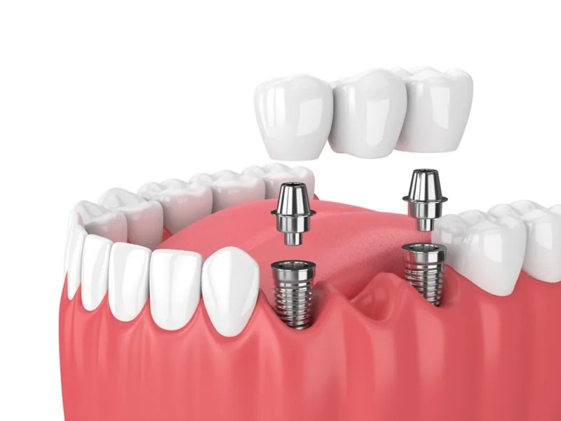 Orthodontix Dental Clinic photo 6