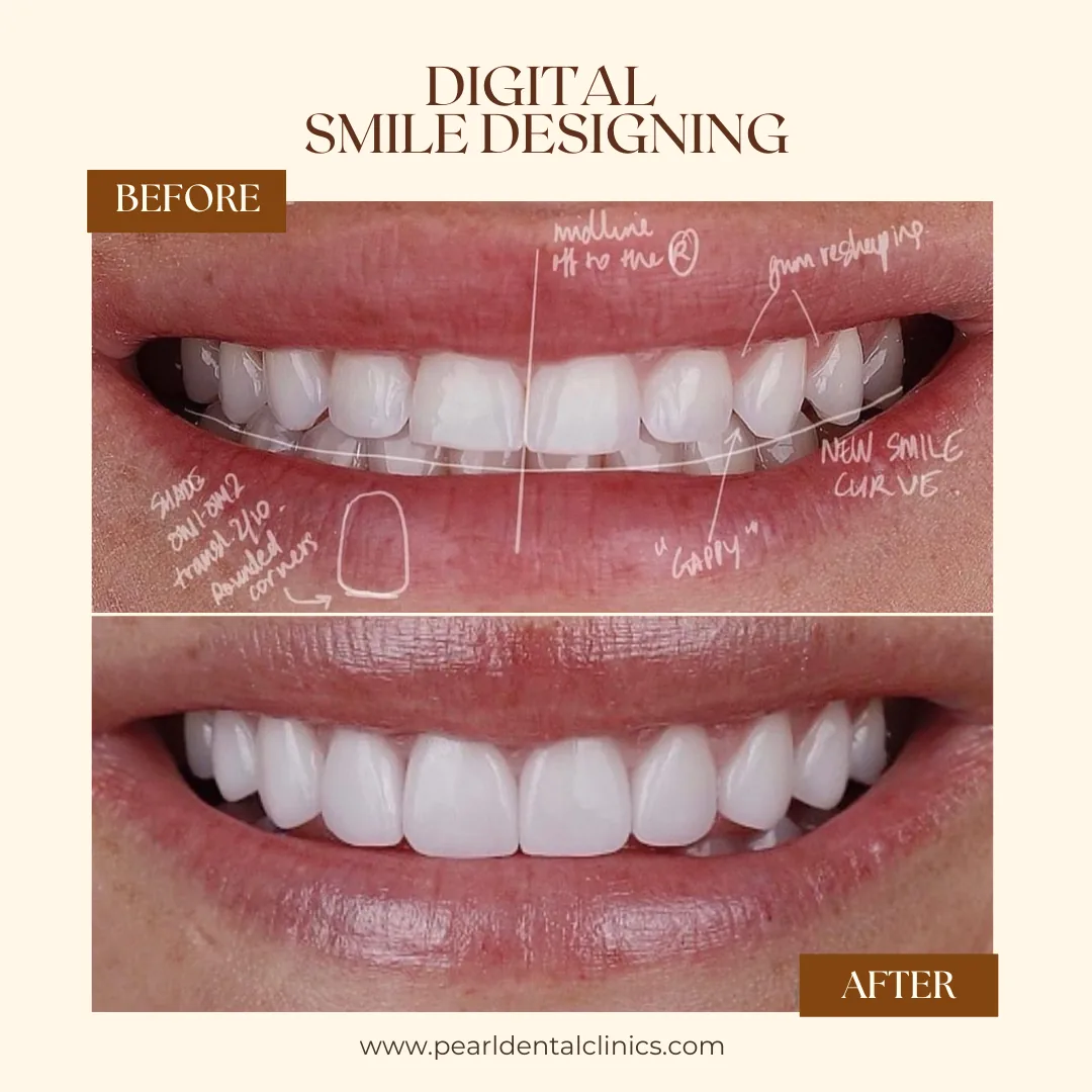 Pearl Dental Clinic Dubai photo 3