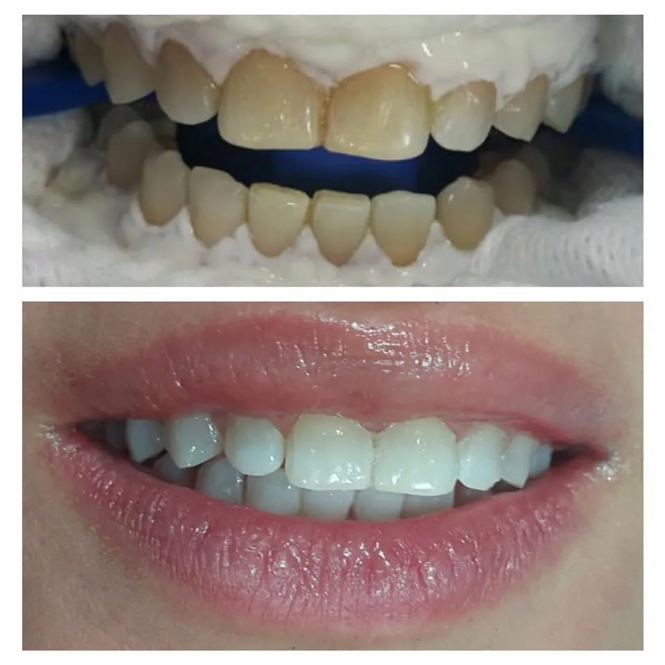 Dental emergency 24/7 at Northwest Clinic photo 5