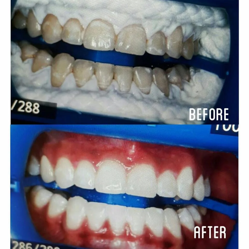 Dental emergency 24/7 at Northwest Clinic photo 6